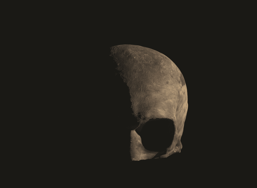 “Few Heads with Knowledge so Inform’d” – Robert Burns and Phrenology