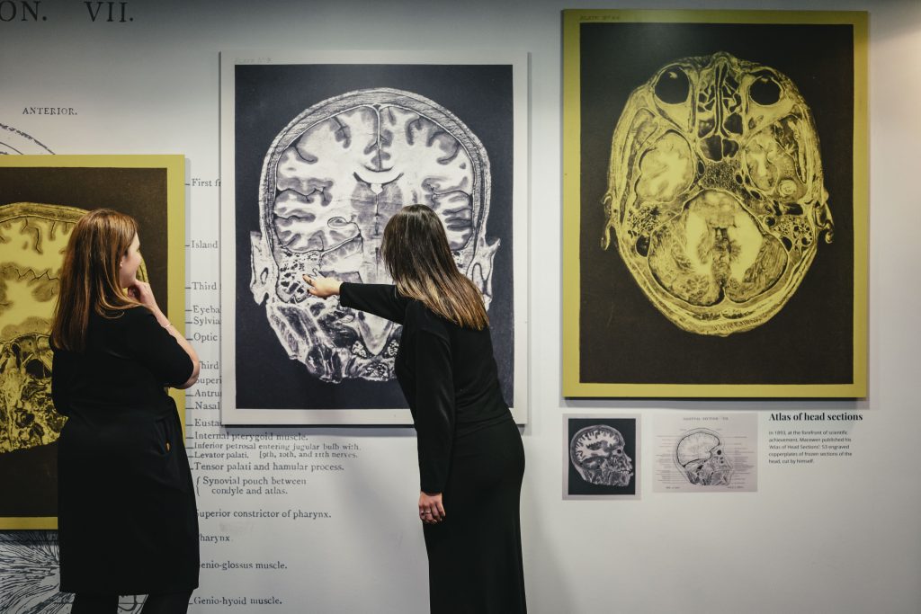 Visitors admire wall display depicting brain mapping by Macewen in exhibition.